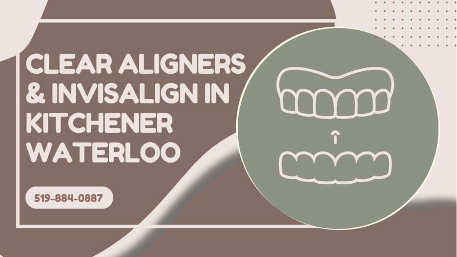 Clear Aligners and Invisalign in Kitchener Waterloo 