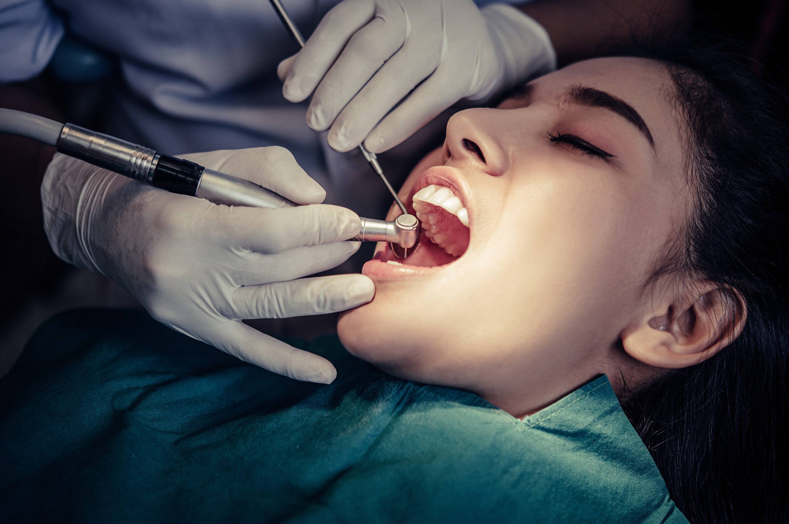 Root Canal Treatment in Kitchener Waterloo