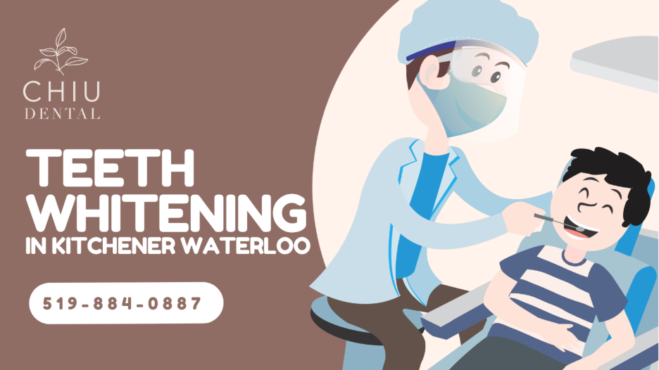 Root Canal Treatment in Kitchener Waterloo