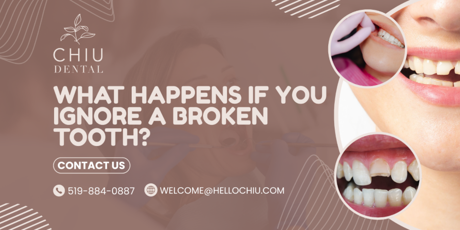 What Happens If You Ignore a Broken Tooth?